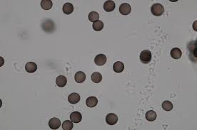 Attēlu rezultāti vaicājumam “Badhamia lilacina macro”