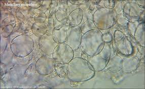 Attēlu rezultāti vaicājumam “Myriosclerotinia scirpicola”