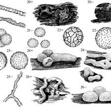 Attēlu rezultāti vaicājumam “Perichaena corticalis spores”