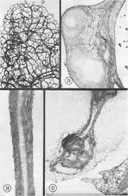 Attēlu rezultāti vaicājumam “Stemonitis virginiensis spores”