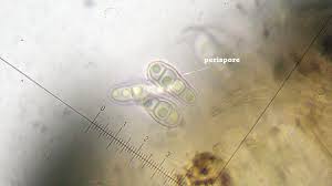 Attēlu rezultāti vaicājumam “Plectocarpon lichenum”