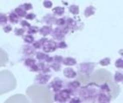 Attēlu rezultāti vaicājumam “Cribraria purpurea plasmodium”