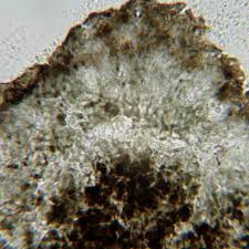 Attēlu rezultāti vaicājumam “Arthonia byssacea”