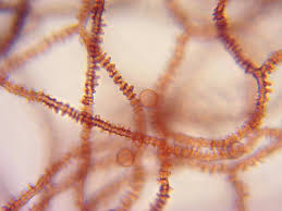 Attēlu rezultāti vaicājumam “Arcyria helvetica macro”