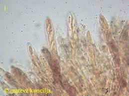 Attēlu rezultāti vaicājumam “Mollisia amenticola”