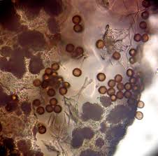 Attēlu rezultāti vaicājumam “Lycogala ustulatum macro”