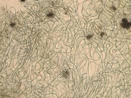 Attēlu rezultāti vaicājumam “Nostoc commune macro”