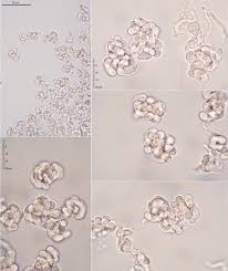 Attēlu rezultāti vaicājumam “Illosporiopsis christiansenii”