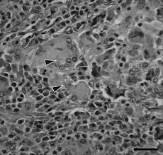 Attēlu rezultāti vaicājumam “Oxyporus corticola”