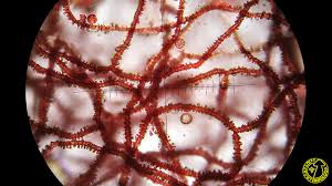 Attēlu rezultāti vaicājumam “Arcyria affinis”