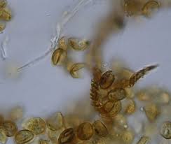 Attēlu rezultāti vaicājumam “Trichia contorta”