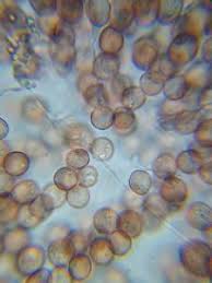 Attēlu rezultāti vaicājumam “Diderma chondrioderma spores”