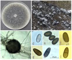 Attēlu rezultāti vaicājumam “Badhamia flavoglauca spores”