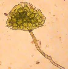 Attēlu rezultāti vaicājumam “Tetraphis pellucida”