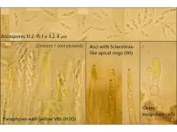 Attēlu rezultāti vaicājumam “Chlorencoelia versiformis”