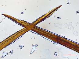Attēlu rezultāti vaicājumam “Timmia megapolitana”