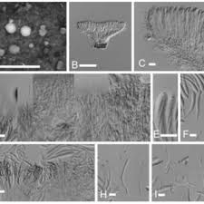 Attēlu rezultāti vaicājumam “Mollisia amenticola”