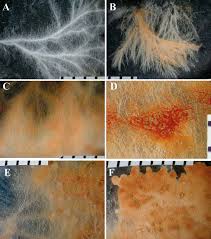 Attēlu rezultāti vaicājumam “Crustoderma dryinum”