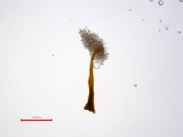 Attēlu rezultāti vaicājumam “Didymium xanthopus spores”