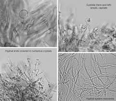 Attēlu rezultāti vaicājumam “Radula complanata sporophyte”