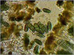 Attēlu rezultāti vaicājumam “Physconia distorta”