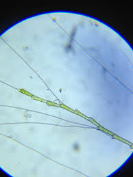 Attēlu rezultāti vaicājumam “Bulbochaete mirabilis”