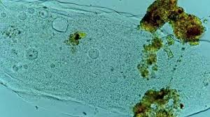 Attēlu rezultāti vaicājumam “Amaurochaete fusiformis”