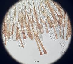 Attēlu rezultāti vaicājumam “Cheilymenia stercorea”