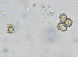 Attēlu rezultāti vaicājumam “Inocybe lanuginosa”