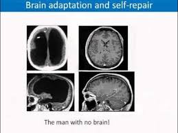 Image result for no brain