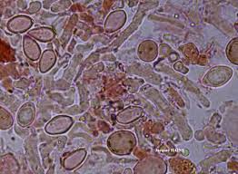 Attēlu rezultāti vaicājumam “Lecanora conizaeoides”