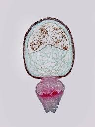 Attēlu rezultāti vaicājumam “Sphagnum centrale sporophyte”