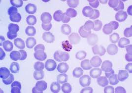 Attēlu rezultāti vaicājumam “Diderma cingulatum plasmodium”