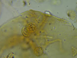 Attēlu rezultāti vaicājumam “Oligonema flavidum spores”