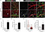 Frontiers | Fractalkine Signaling Attenuates Perivascular ...