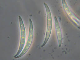 Attēlu rezultāti vaicājumam “Didymium verrucisporum spores”
