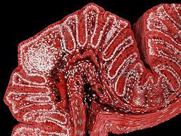 Attēlu rezultāti vaicājumam “Heterotrichia pomiformis (syn. Arcyria pomiformis) macro”