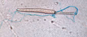 Attēlu rezultāti vaicājumam “Cribraria costata spores”