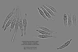 Attēlu rezultāti vaicājumam “Opegrapha atra”