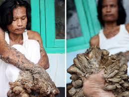 Image result for Lewandowsky-Lutz