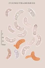 Attēlu rezultāti vaicājumam “Exidia cartilaginea”