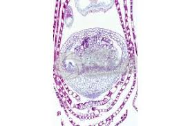 Attēlu rezultāti vaicājumam “Sphagnum sporophyte”