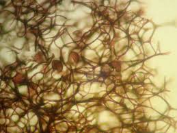 Attēlu rezultāti vaicājumam “Lamproderma gulielmae”