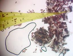 Attēlu rezultāti vaicājumam “Badhamia lilacina sessile”