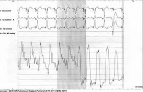 Image result for Cambridge Rhc