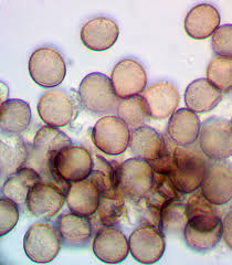 Attēlu rezultāti vaicājumam “Physarum alexandrowiczii spores”