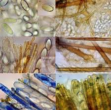 Attēlu rezultāti vaicājumam “Cheilymenia stercorea”