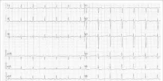 Image result for Vcd Ttc