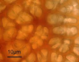 Attēlu rezultāti vaicājumam “Pucciniastrum areolatum”