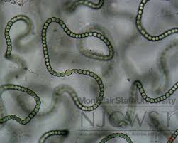 Attēlu rezultāti vaicājumam “Nostoc commune macro”